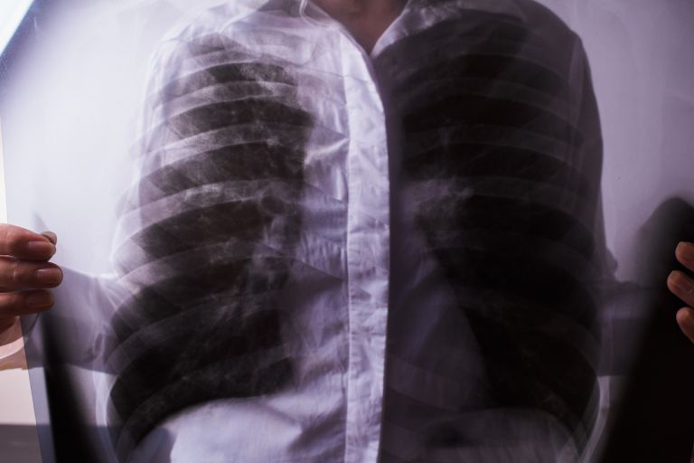 歯科矯正の進化とワイヤー治療の魅力確実性と快適さを両立する最新アプローチ