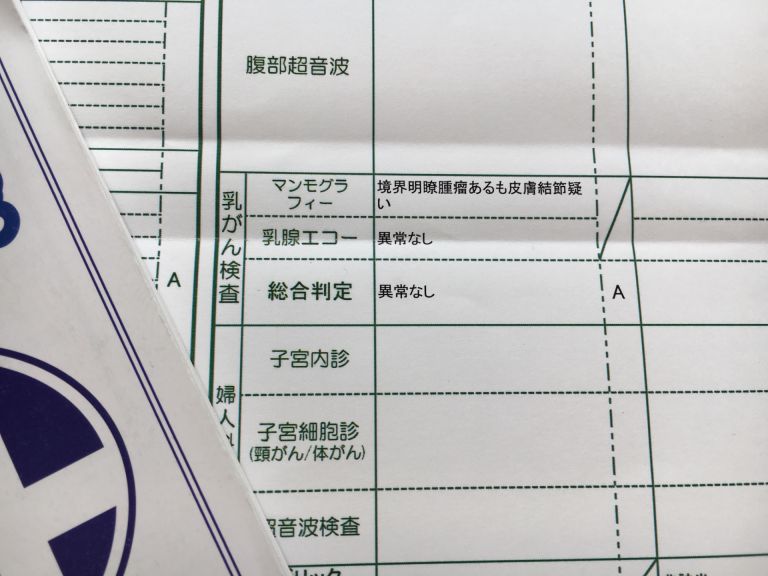 歯科矯正で叶える健康と美しい歯並び人生を変える最適な選択とその秘訣